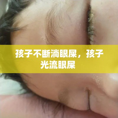 孩子不断淌眼屎,孩子光流眼屎